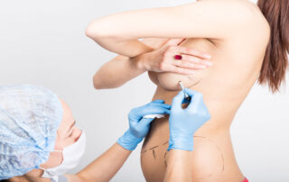 Woman getting ready for breast surgery - Pietro Di Mauro