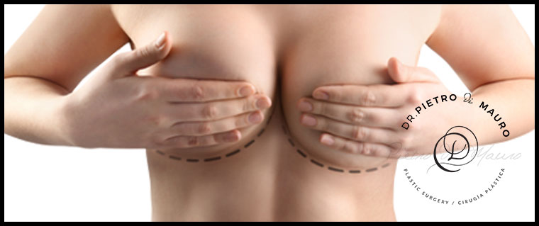 breast lift - Pietro Di Mauro