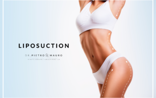 Achieve a new you for the New Year with liposuction