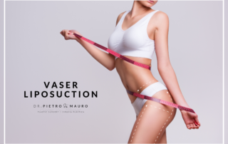 vaser liposuction - Pietro di Mauro