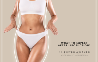 What to expect after liposuction - Pietro di Mauro