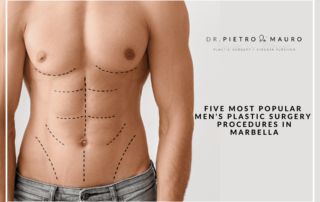 Five most popular men`s plastic surgery procedures in Marbella - Pietro di Mauro
