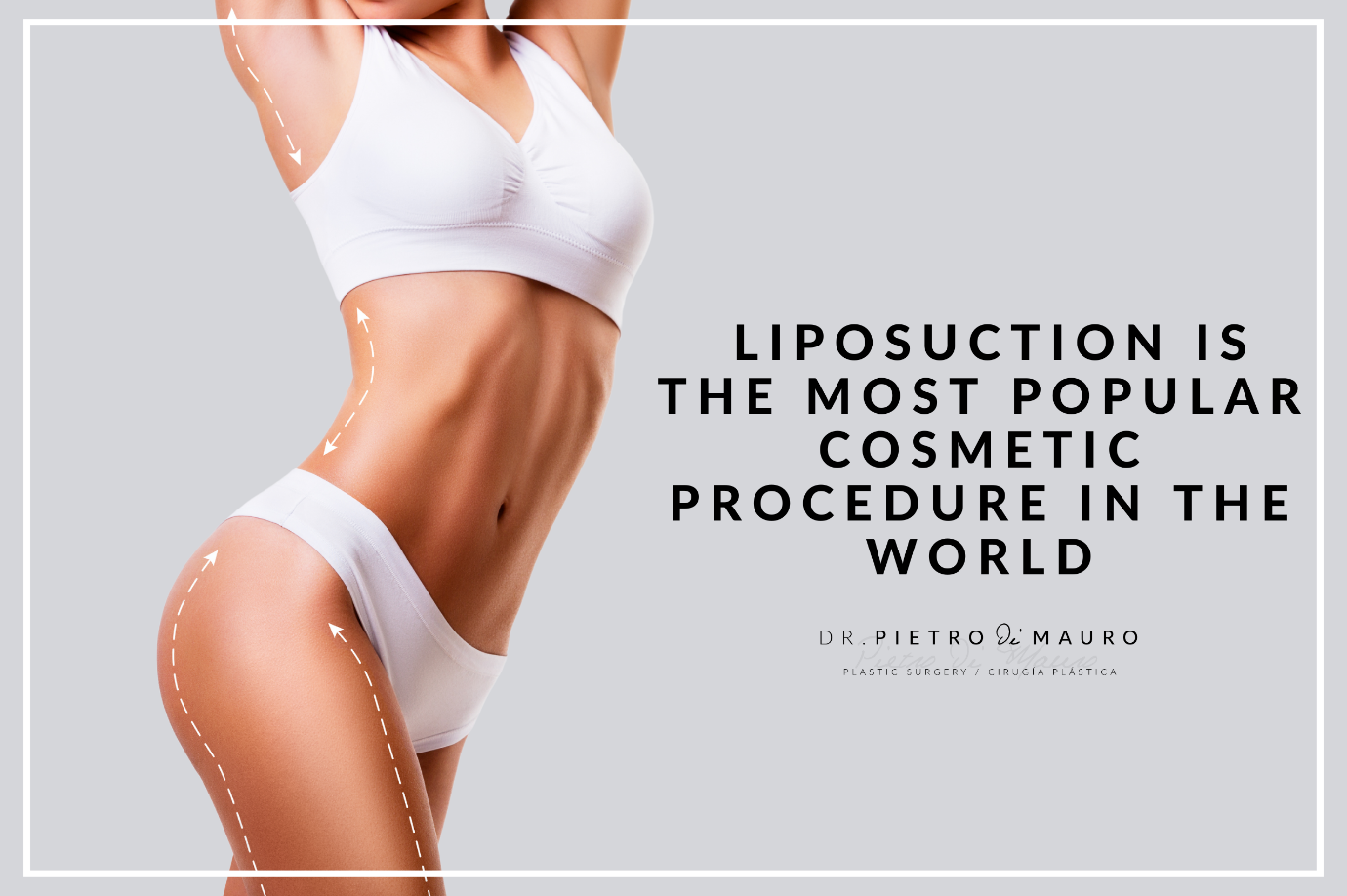 Liposuction is the most popular cosmetic procedure in the world - blog - Pietro di Mauro