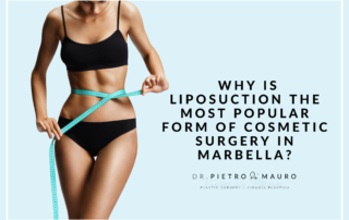 Why is liposuction the most popular form of cosmetic surgery in Marbella? - Blog Pietro di Mauro